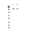 CD11C antibody, PA5-79537, Invitrogen Antibodies, Western Blot image 