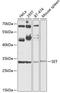SET Nuclear Proto-Oncogene antibody, orb541574, Biorbyt, Western Blot image 