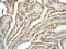 Cathepsin B antibody, ab125067, Abcam, Immunohistochemistry paraffin image 