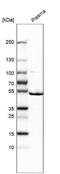 CMP-N-acetylneuraminate-beta-galactosamide-alpha-2,3-sialyltransferase 1 antibody, NBP1-87045, Novus Biologicals, Western Blot image 