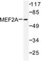 Myocyte Enhancer Factor 2A antibody, LS-C176115, Lifespan Biosciences, Western Blot image 