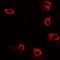 Acid Phosphatase 5, Tartrate Resistant antibody, orb377892, Biorbyt, Immunofluorescence image 