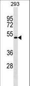 RCC1 And BTB Domain Containing Protein 1 antibody, LS-C162513, Lifespan Biosciences, Western Blot image 