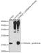 Cyclin-dependent kinase inhibitor 2A, isoforms 1/2/3 antibody, GTX03119, GeneTex, Immunoprecipitation image 