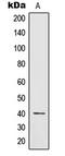 Interleukin 12B antibody, LS-C352371, Lifespan Biosciences, Western Blot image 