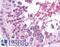 SWI/SNF Related, Matrix Associated, Actin Dependent Regulator Of Chromatin, Subfamily A, Member 4 antibody, LS-B4506, Lifespan Biosciences, Immunohistochemistry paraffin image 