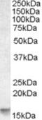 Phorbol-12-Myristate-13-Acetate-Induced Protein 1 antibody, EB09119, Everest Biotech, Western Blot image 