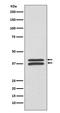 Mitogen-Activated Protein Kinase Kinase 3 antibody, M02916, Boster Biological Technology, Western Blot image 
