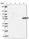 Nitric Oxide Synthase 1 Adaptor Protein antibody, PA5-63147, Invitrogen Antibodies, Western Blot image 