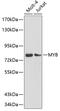 MYB Proto-Oncogene, Transcription Factor antibody, 19-017, ProSci, Western Blot image 