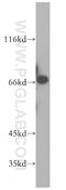Kinesin Light Chain 2 antibody, 17668-1-AP, Proteintech Group, Western Blot image 