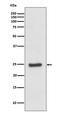 Zinc And Ring Finger 2 antibody, M11505, Boster Biological Technology, Western Blot image 