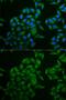 CD247 Molecule antibody, GTX53919, GeneTex, Immunocytochemistry image 