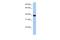 Zinc Finger Protein 781 antibody, A17652, Boster Biological Technology, Western Blot image 