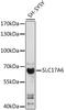 Solute Carrier Family 17 Member 6 antibody, LS-C750150, Lifespan Biosciences, Western Blot image 