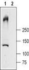 Ryanodine receptor type 1 antibody, TA329024, Origene, Western Blot image 