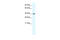 Transient Receptor Potential Cation Channel Subfamily M Member 3 antibody, 28-562, ProSci, Western Blot image 