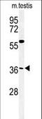 Coiled-Coil Domain Containing 92 antibody, LS-C168382, Lifespan Biosciences, Western Blot image 