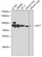 Exostosin Glycosyltransferase 1 antibody, 18-455, ProSci, Western Blot image 