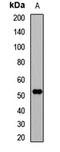 ETS Proto-Oncogene 2, Transcription Factor antibody, LS-C667723, Lifespan Biosciences, Western Blot image 