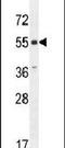 Atypical Chemokine Receptor 3 antibody, PA5-23988, Invitrogen Antibodies, Western Blot image 