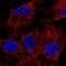 Tripartite Motif Containing 2 antibody, NBP1-81504, Novus Biologicals, Immunocytochemistry image 