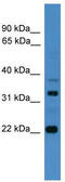Archaelysin Family Metallopeptidase 2 antibody, TA336023, Origene, Western Blot image 