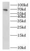 Interleukin 1 Receptor Like 2 antibody, FNab04246, FineTest, Western Blot image 