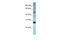 Eukaryotic Translation Initiation Factor 4E antibody, A00135-1, Boster Biological Technology, Western Blot image 