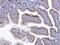 Thymocyte Selection Associated High Mobility Group Box antibody, A08441-2, Boster Biological Technology, Immunohistochemistry paraffin image 