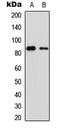 Olfactomedin Like 2B antibody, LS-C356234, Lifespan Biosciences, Western Blot image 