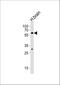 Zinc Finger Protein 610 antibody, A16167, Boster Biological Technology, Western Blot image 