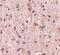 DLG Associated Protein 2 antibody, PA5-20541, Invitrogen Antibodies, Immunohistochemistry paraffin image 