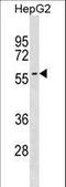 Sphingomyelin Phosphodiesterase 3 antibody, LS-C159044, Lifespan Biosciences, Western Blot image 