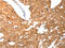 Poly(ADP-Ribose) Polymerase 1 antibody, CSB-PA034443, Cusabio, Immunohistochemistry paraffin image 