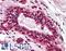 Mismatch repair endonuclease PMS2 antibody, LS-B1980, Lifespan Biosciences, Immunohistochemistry paraffin image 