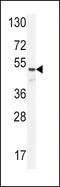 Angiopoietin 1 antibody, LS-C156332, Lifespan Biosciences, Western Blot image 