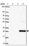 SLAM Family Member 7 antibody, NBP2-37951, Novus Biologicals, Western Blot image 