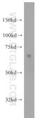 Splicing Factor 3a Subunit 2 antibody, 15596-1-AP, Proteintech Group, Western Blot image 