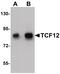 Transcription Factor 12 antibody, PA5-21039, Invitrogen Antibodies, Western Blot image 