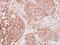 Insulin Receptor antibody, GTX111314, GeneTex, Immunohistochemistry paraffin image 