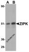 ZIPK antibody, 2067, ProSci Inc, Western Blot image 