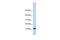 Transmembrane Protein 254 antibody, GTX45960, GeneTex, Western Blot image 