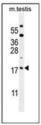 ORMDL Sphingolipid Biosynthesis Regulator 3 antibody, AP53120PU-N, Origene, Western Blot image 