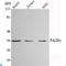 Proteasome Activator Subunit 3 antibody, LS-C813072, Lifespan Biosciences, Western Blot image 