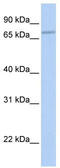 Coenzyme Q8A antibody, TA346630, Origene, Western Blot image 