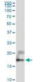 Ubiquitously Expressed Prefoldin Like Chaperone antibody, H00008409-B01P, Novus Biologicals, Western Blot image 