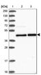 MPTP antibody, NBP2-48841, Novus Biologicals, Western Blot image 