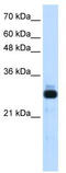 Sin3A Associated Protein 30 antibody, TA343429, Origene, Western Blot image 
