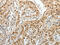 Proteasome 26S Subunit, Non-ATPase 14 antibody, CSB-PA967586, Cusabio, Immunohistochemistry paraffin image 